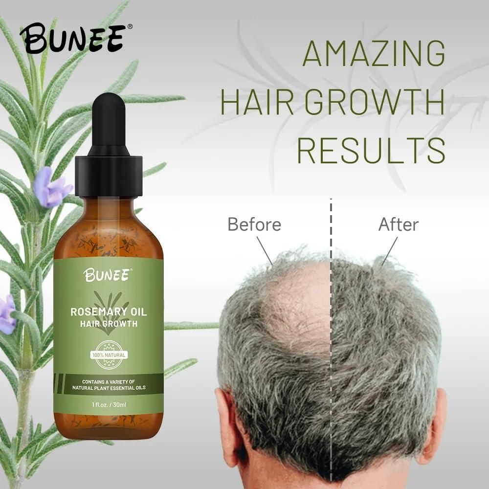 BUNEE Rosemary Hair Growth Serum Oil 30 ML