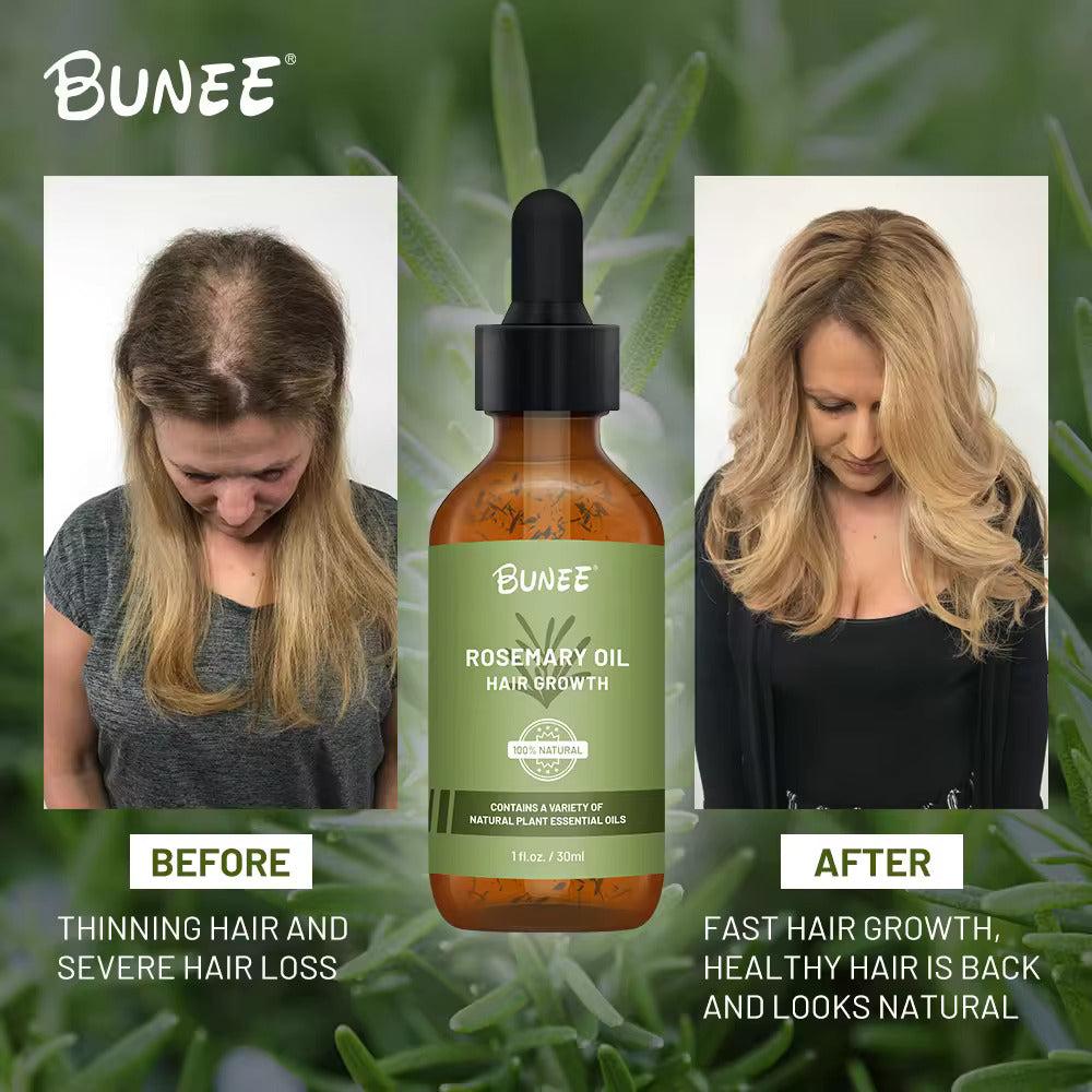 BUNEE Rosemary Hair Growth Serum Oil 30 ML